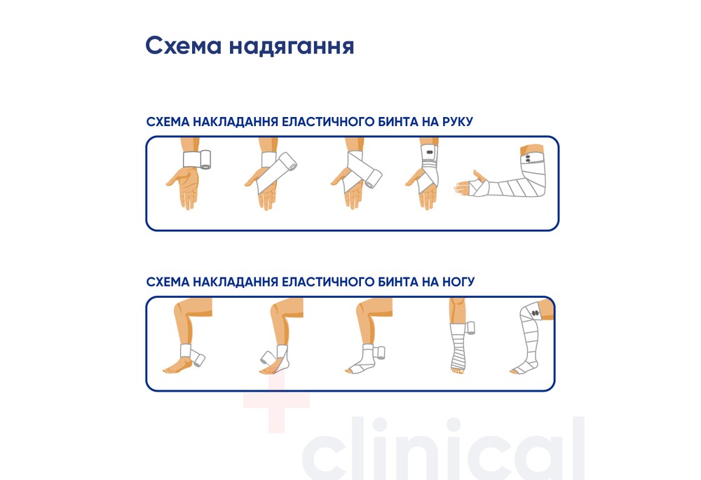 Бинт еластичний Медтекстиль високої розтяжності, без латексу 1 м x 8 см